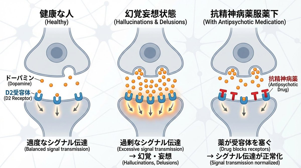 Dopamine and schizophrenia synapse diagram — example 1