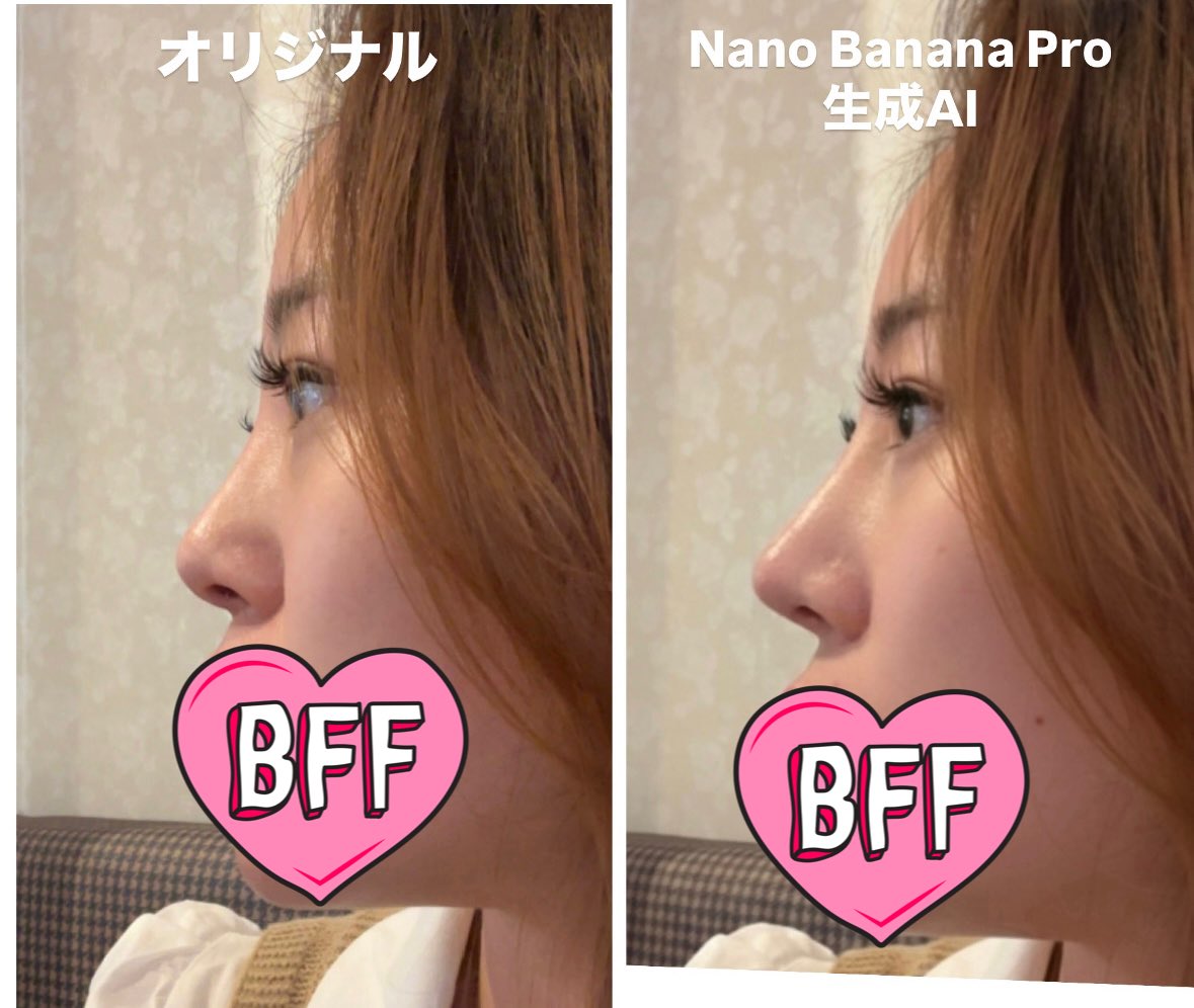 Generating Ideal Nose Shapes for Cosmetic Surgery Consultation