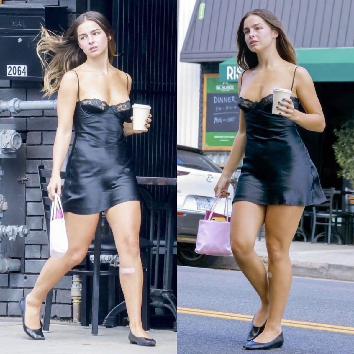 Candid Street Fashion Shot with Bandage Detail — example 3